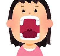 安佐北区　歯医者　開咬（かいこう）になることも