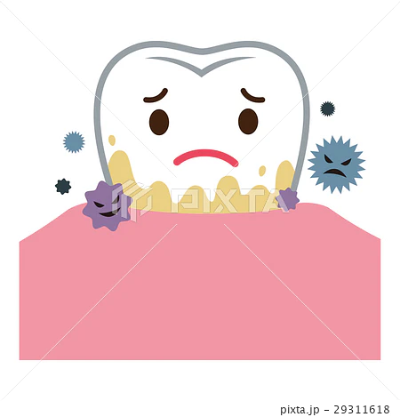 安佐北区 歯医者 歯石はどうして悪いの?