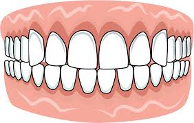 安佐北区　歯医者　