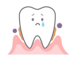 安佐北区　歯医者　歯周病の原因について