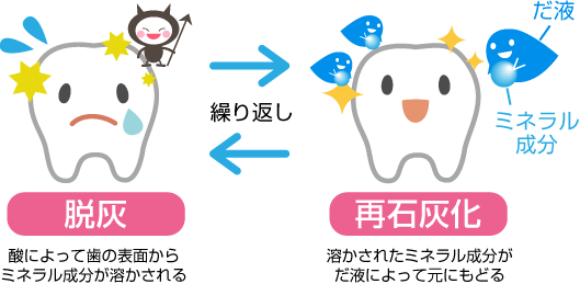 安佐北区　歯医者　虫歯はどうやってできるの？