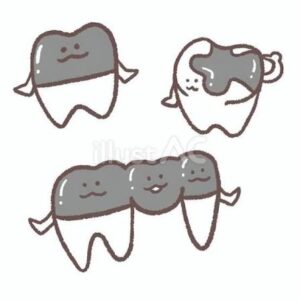 安佐北区の歯医者「かわもと歯科・こども歯科クリニック」のそもそも「補綴（ほてつ）」とは？
